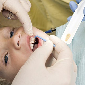 Child receiving fluoride treatment in Dallas